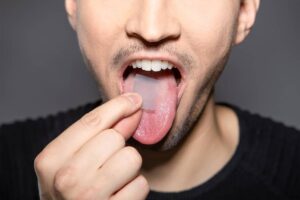 nicotine-dental-strips